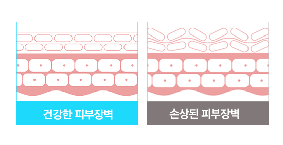 피부 장벽 비교 그림
출처 : 하이닥뉴스